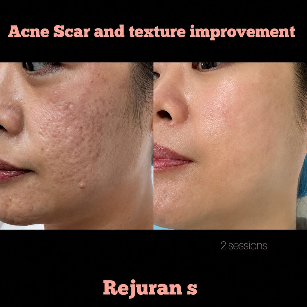 reviews rejuran s